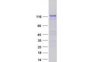 Western Blotting (WB) image for Synaptopodin (SYNPO) (Transcript Variant 3) protein (Myc-DYKDDDDK Tag) (ABIN2733062)