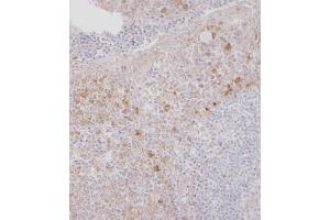 Immunohistochemical analysis of B on paraffin-embedded Human tonsil tissue. (CSF1R Antikörper  (C-Term))