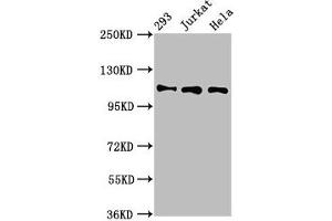Western Blot Positive WB detected in: 293 whole cell lysate, Jurkat whole cell lysate, Hela whole cell lysate All lanes: RAB3GAP1 antibody at 7 μg/mL Secondary Goat polyclonal to rabbit IgG at 1/50000 dilution Predicted band size: 111, 112, 106 kDa Observed band size: 111 kDa (RAB3GAP1 Antikörper  (Catalytic Subunit))
