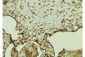 ABIN6269347 at 1/100 staining Mouse colon tissue by IHC-P. (G3BP1 Antikörper  (Internal Region))