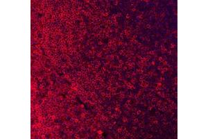 IF analysis of CD79A using anti-CD79A antibody (ABIN3043397). (CD79a Antikörper  (AA 121-226))