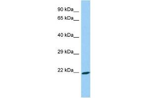 Host: Rabbit Target Name: ASB18 Sample Type: Fetal Liver lysates Antibody Dilution: 1. (ASB18 Antikörper  (N-Term))