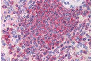 Human Spleen (formalin-fixed, paraffin-embedded) stained with ARPC2 antibody ABIN351464 at 3. (ARPC2 Antikörper  (AA 288-300))