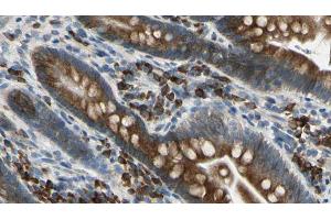 ABIN6274670 at 1/100 staining Mouse intestine tissue by IHC-P. (GRID1 Antikörper  (Internal Region))