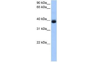 SERPINA5 antibody used at 1 ug/ml to detect target protein. (SERPINA5 Antikörper  (C-Term))