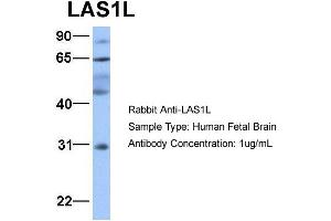 Host:  Rabbit  Target Name:  LAS1L  Sample Type:  Human Fetal Brain  Antibody Dilution:  1. (LAS1L Antikörper  (Middle Region))