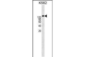 Western blot analysis in K562 cell line lysates (35ug/lane). (P-Glycoprotein Antikörper  (AA 647-677))