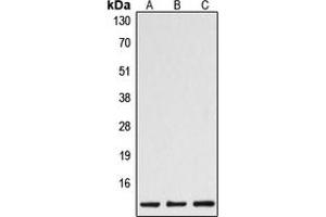 Western blot analysis of Caspase 1 p10 expression in HeLa (A), mouse spleen (B), rat spleen (C) whole cell lysates. (Caspase 1 (p10) Antikörper  (C-Term))