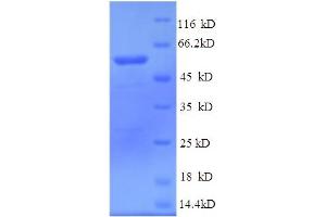 SDS-PAGE (SDS) image for Phospholipid Transfer Protein (PLTP) (AA 18-493) protein (His tag) (ABIN4975931) (PLTP Protein (AA 18-493) (His tag))