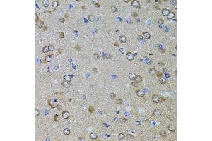 Immunohistochemistry of paraffin-embedded rat brain using GM13125 antibody. (Pramel15 Antikörper)