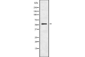 Western blot analysis of RPA49 using K562 whole cell lysates (POLR1E Antikörper  (Internal Region))