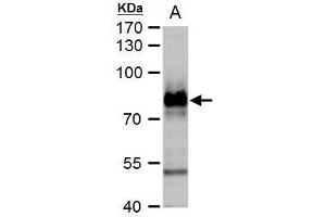 Western Blotting (WB) image for anti-Small Nuclear Ribonucleoprotein Polypeptide E (SNRPE) (Internal Region) antibody (ABIN2854894)