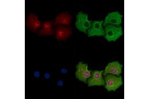ABIN6258571 and ABIN6274564 staining Hela cells by IF/ICC.