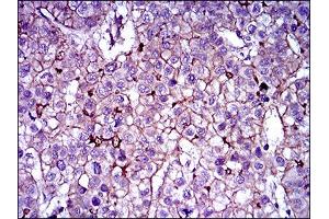 Flow cytometric analysis of HepG2 cells using ABCB5 antibody (green) and negative control (purple). (ABCB5 Antikörper  (AA 481-674))