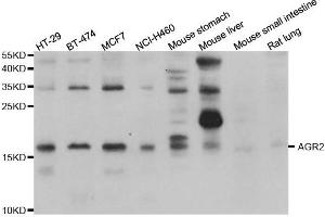Western blot analysis of extracts of various cell lines, using AGR2 antibody.
