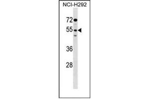 Western blot analysis of D172g / SIRPG in NCI-H292 cell line lysates (35ug/lane). (SIRPG Antikörper  (Middle Region))