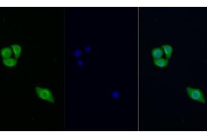 Detection of PIK3Cb in Human Hela cell using Polyclonal Antibody to Phosphoinositide-3-Kinase Catalytic Beta Polypeptide (PIK3Cb) (PIK3CB Antikörper  (AA 807-1070))