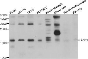 Western blot analysis of extracts of various cell lines, using AGR2 antibody (ABIN5975470) at 1/1000 dilution. (AGR2 Antikörper)