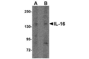 Image no. 1 for anti-Interleukin 16 (IL16) (N-Term) antibody (ABIN341724) (IL16 Antikörper  (N-Term))