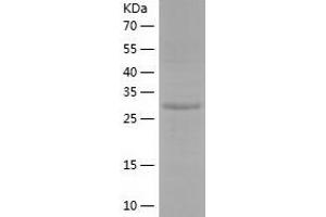 Western Blotting (WB) image for NECAP Endocytosis Associated 2 (NECAP2) (AA 1-263) protein (His tag) (ABIN7124122) (NECAP2 Protein (AA 1-263) (His tag))
