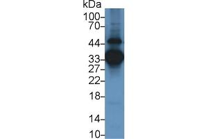 Detection of ANXA3 in Human Lung lysate using Monoclonal Antibody to Annexin A3 (ANXA3) (Annexin A3 Antikörper  (AA 190-312))
