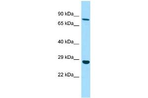 WB Suggested Anti-EMILIN3 Antibody Titration: 1. (EMILIN3 Antikörper  (C-Term))