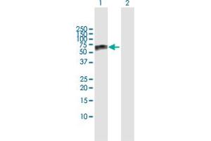 Western Blot analysis of GBA expression in transfected 293T cell line by GBA MaxPab polyclonal antibody. (GBA Antikörper  (AA 1-536))