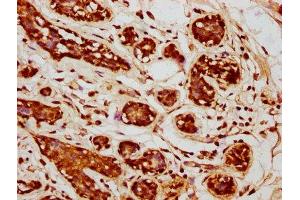 Immunohistochemistry (IHC) image for anti-Wingless-Type MMTV Integration Site Family, Member 9A (WNT9A) (AA 206-365) antibody (ABIN7166319)