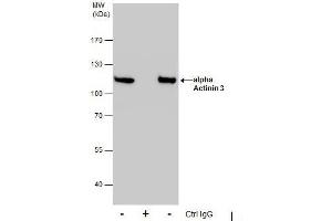 Immunoprecipitation (IP) image for anti-Actinin, alpha 3 (ACTN3) (Center) antibody (ABIN2855581)