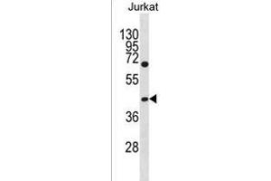 GCNT6 Antibody (C-term) (ABIN1536996 and ABIN2850077) western blot analysis in Jurkat cell line lysates (35 μg/lane). (GCNT6 Antikörper  (C-Term))