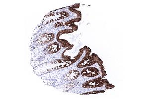 colon descendens mucosa (Rekombinanter KRT20 Antikörper  (AA 196-323))