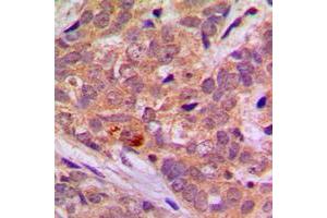 Immunohistochemistry (IHC) image for anti-serine/threonine Kinase 11 (STK11) (C-Term) antibody (ABIN7299474)