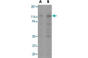 Western blot analysis of APAF1 in K-562 cell lysate with APAF1 monoclonal antibody, clone 2E10  at (A) 0. (APAF1 Antikörper  (C-Term))