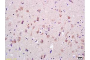 Formalin-fixed and paraffin embedded rat brain labeled with Rabbit Anti GluR1/AMPA Polyclonal Antibody, Unconjugated (ABIN1385842) at 1:200 followed by conjugation to the secondary antibody and DAB staining (GluR1, GluR2 Antikörper  (AA 141-240))
