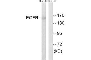 Western Blotting (WB) image for anti-Epidermal Growth Factor Receptor (EGFR) (Ser1026) antibody (ABIN1848177) (EGFR Antikörper  (Ser1026))