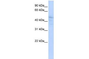 DLL3 antibody used at 1 ug/ml to detect target protein.