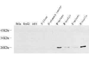 Western Blot analysis of various samples using p19 INK4d Polyclonal Antibody at dilution of 1:500. (CDKN2D Antikörper)