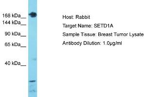 Host: Rabbit Target Name: SETD1A Sample Type: Breast Tumor lysates Antibody Dilution: 1. (SETD1A Antikörper  (C-Term))