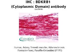 Image no. 2 for anti-Bradykinin Receptor B1 (BDKRB1) (1st Cytoplasmic Domain) antibody (ABIN1732268) (BDKRB1 Antikörper  (1st Cytoplasmic Domain))