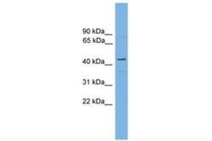 Image no. 1 for anti-Retinol Dehydrogenase 16 (All-Trans) (RDH16) (AA 215-264) antibody (ABIN6744714) (RDH16 Antikörper  (AA 215-264))