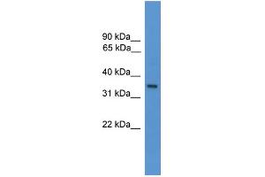 WB Suggested Anti-OR1J1 Antibody Titration: 1. (OR1J1 Antikörper  (C-Term))