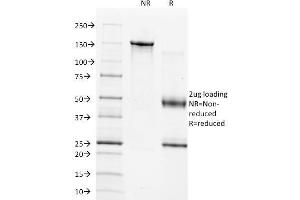 SDS-PAGE Analysis of Purified TIMP1 Mouse Monoclonal Antibody (2A5). (TIMP1 Antikörper  (AA 72-82))