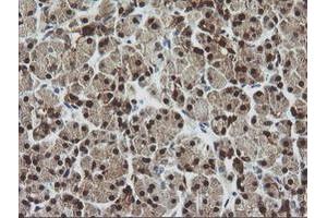 Image no. 1 for anti-Cytidine Monophosphate (UMP-CMP) Kinase 1, Cytosolic (CMPK1) antibody (ABIN1497544) (Cytidine Monophosphate (UMP-CMP) Kinase 1, Cytosolic (CMPK1) Antikörper)