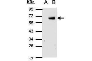 WB Image Western Blot analysis of IRF6 expression in transfected 293T cell line by IRF6 polyclonal antibody.