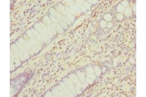 Immunohistochemistry (IHC) image for anti-Protein Phosphatase, Mg2+/Mn2+ Dependent, 1A (PPM1A) (AA 1-382) antibody (ABIN7165941)