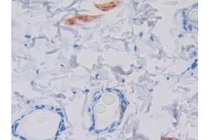Immunohistochemistry (IHC) image for anti-Prolactin-Induced Protein (PIP) (AA 41-139) antibody (ABIN7443821)