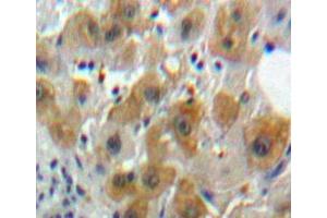 Used in DAB staining on fromalin fixed paraffin-embedded Liver tissue (Caspase 8 Antikörper  (AA 217-384))