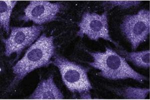 Immunofluorescence staining of C3H/10T1/2 cells (Mouse embryonic fibroblasts, ATCC CCL-226). (NCF2 Antikörper  (AA 317-469))