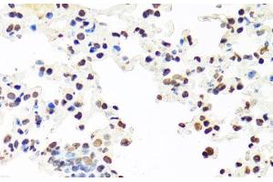 Immunohistochemistry (Paraffin-embedded Sections) (IHC (p)) image for anti-Splicing Factor Proline/glutamine-Ric (SFPQ) antibody (ABIN7255047)