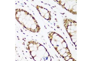 Immunohistochemistry of paraffin-embedded human colon using PCNA antibody (ABIN1874056) at dilution of 1:200 (40x lens). (PCNA Antikörper)